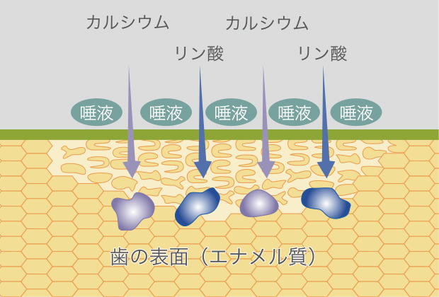 再石灰化（むし歯になりにくい状態）