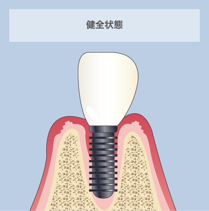 健全状態