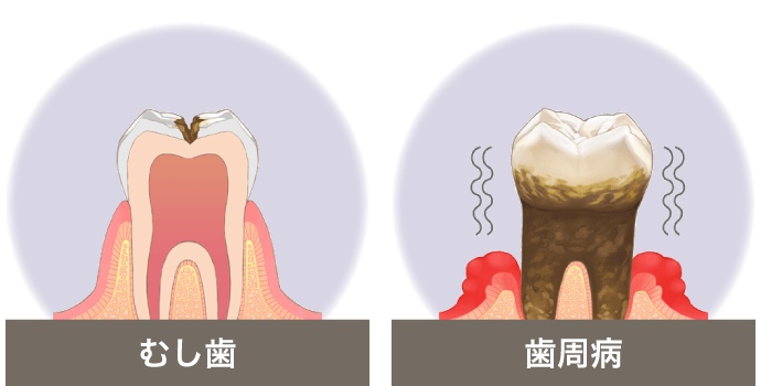 病気（歯科疾患）
