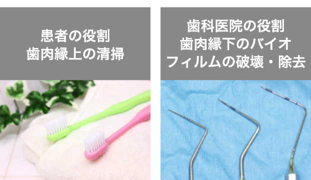 歯周炎の病因論（リスクファクター）