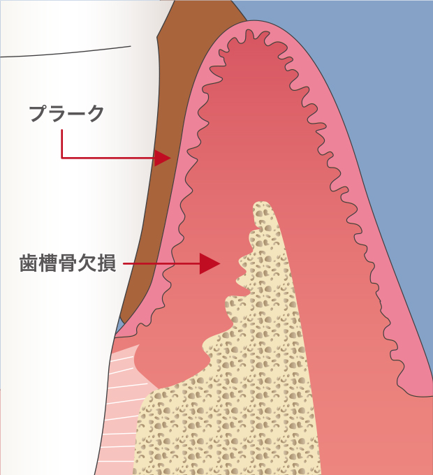 1.治療前