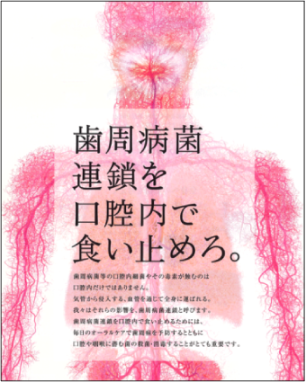 歯周病菌や内毒素、炎症性物質が“血流によって全身に”広がる。