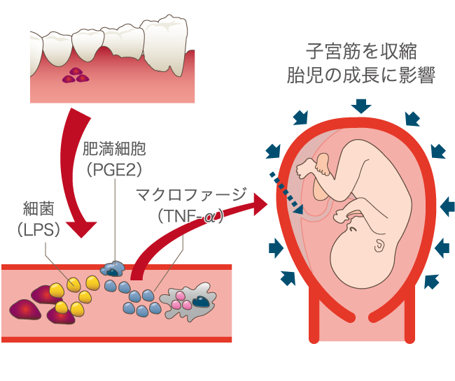 子宮筋を収縮胎児の成長に影響